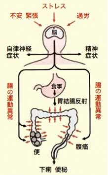 なぜ 下痢 腹痛 腹痛のない水下痢の原因は