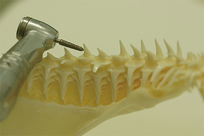 歯を削る機械とサメの顎骨