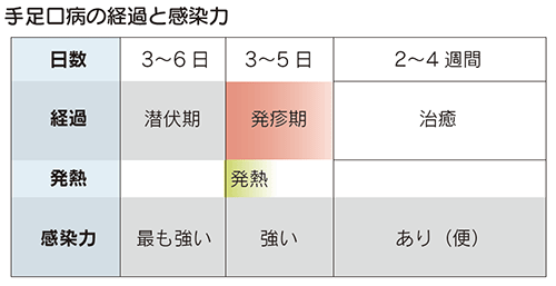 手足口病の経過と感染力