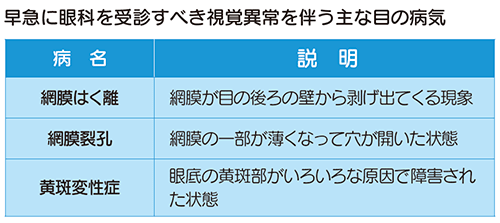 視界 チカチカ