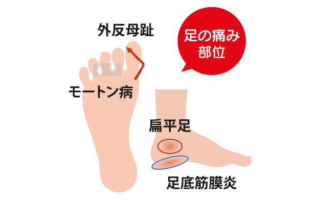 足の痛み部位