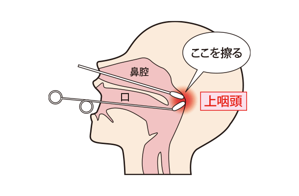 Bスポット療法（EAT)