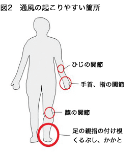 通風の起こりやすい箇所