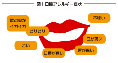 フルーツ ラテックス キウイやフルーツに要注意！ラテックスアレルギー・口腔アレルギー症候群って？