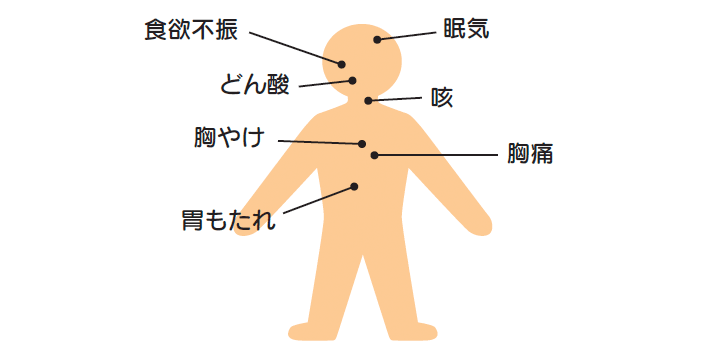 図2.　胃食道逆流症の症状
