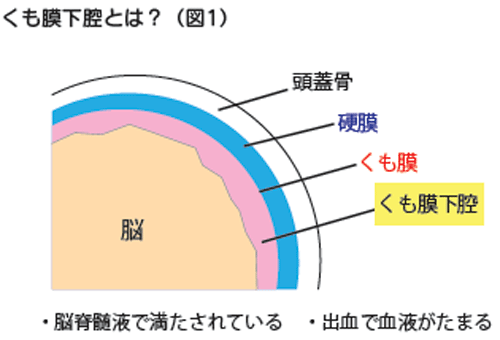 くも膜下腔とは？