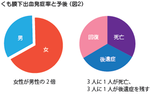 くも膜下出血発症率と予後