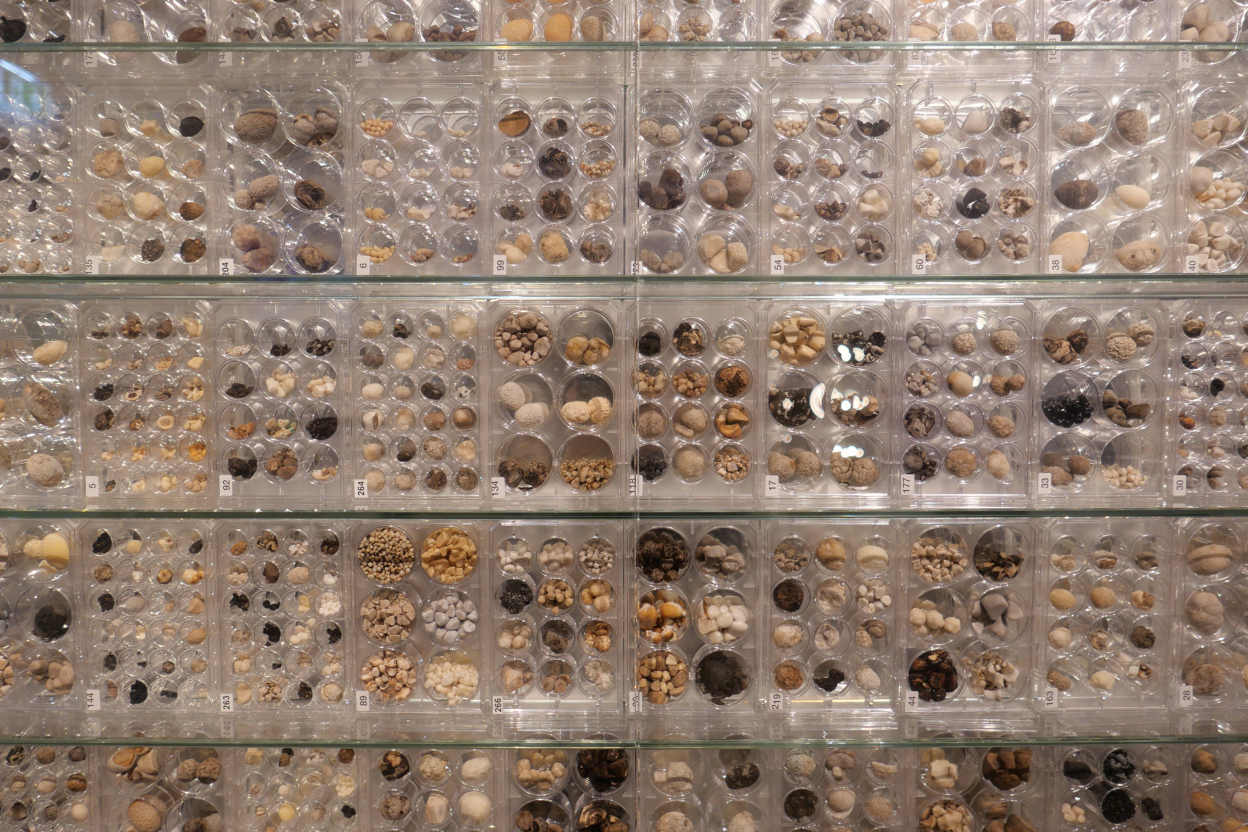 1973年生まれのアーティスト、イラナ・ハルペリンによる人間の結石を素材にした作品